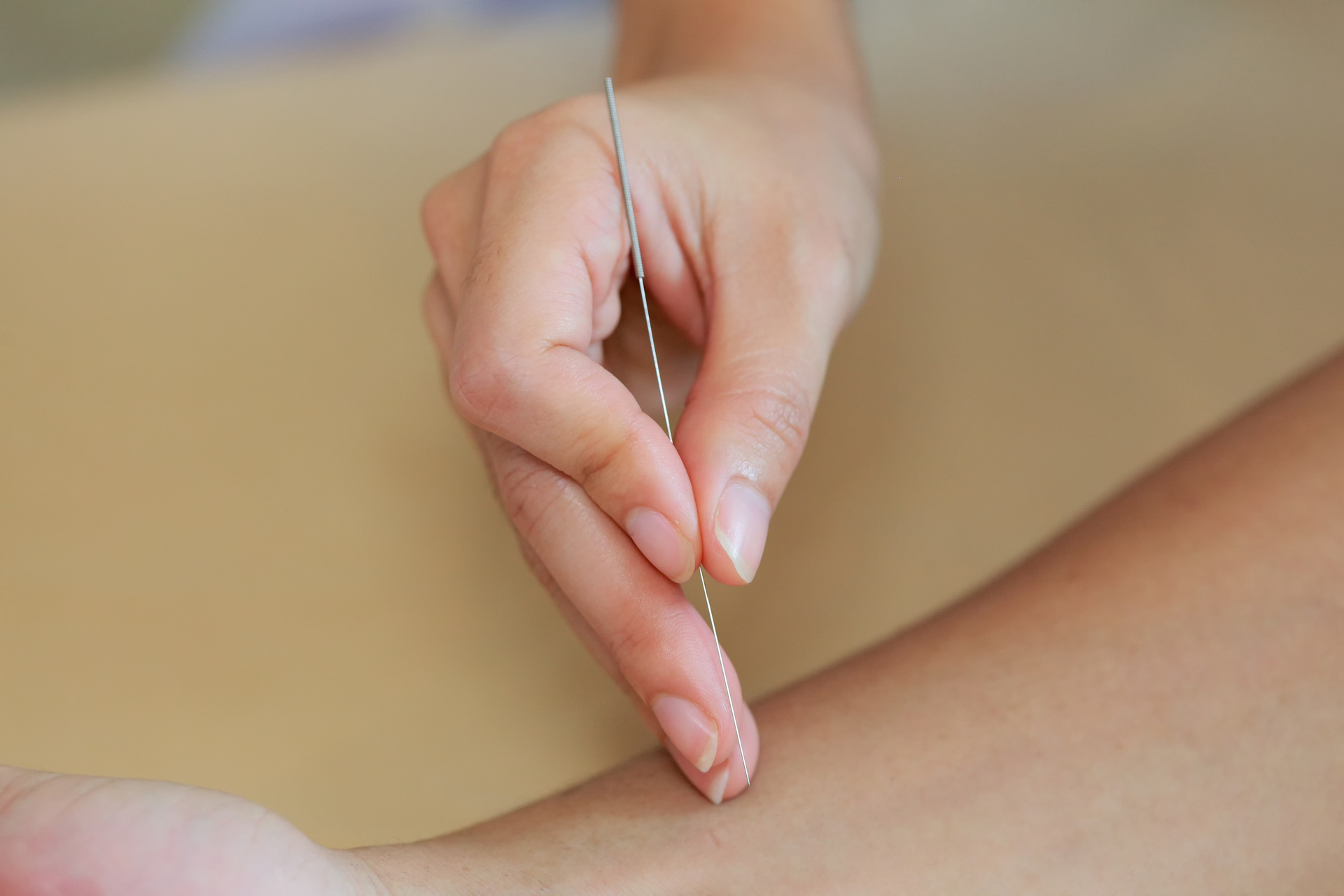 1920-closeup-of-hand-performing-acupuncture-therapy-at-hand-patient.JPG